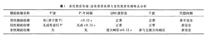 房性期前收缩 、结性期前收缩与室性期前收缩特 点分析