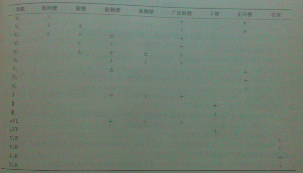 心肌梗死定位的QRS标准