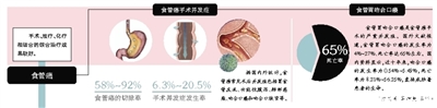 食管胃吻合口瘘中国经验·预防
