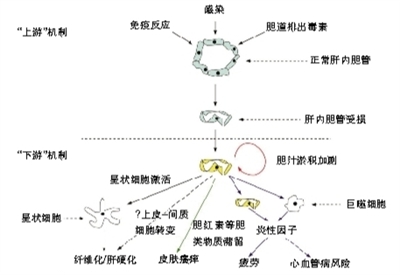 对UDCA应答不良患者的诊断及治疗